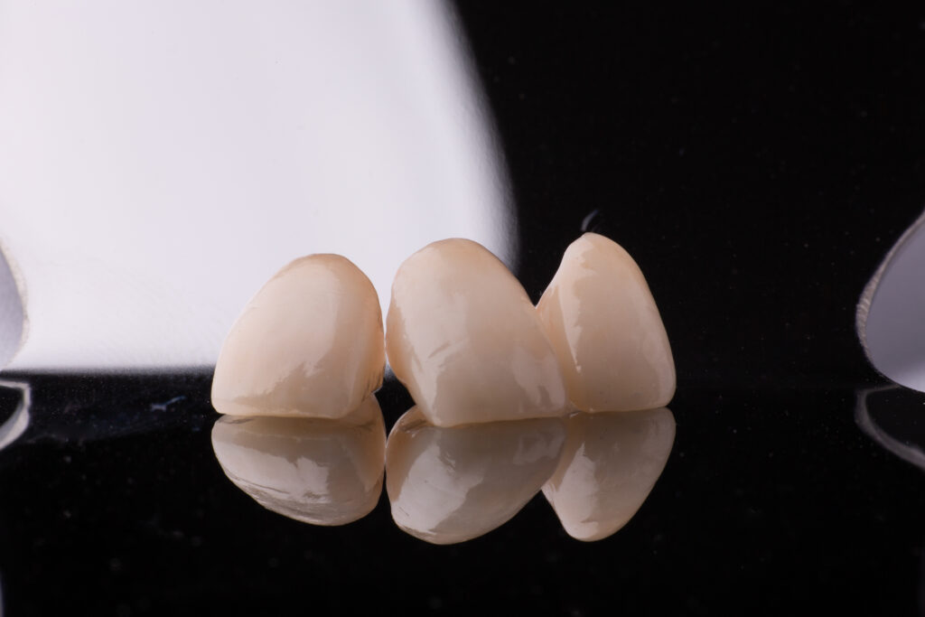 dallas dental crowns